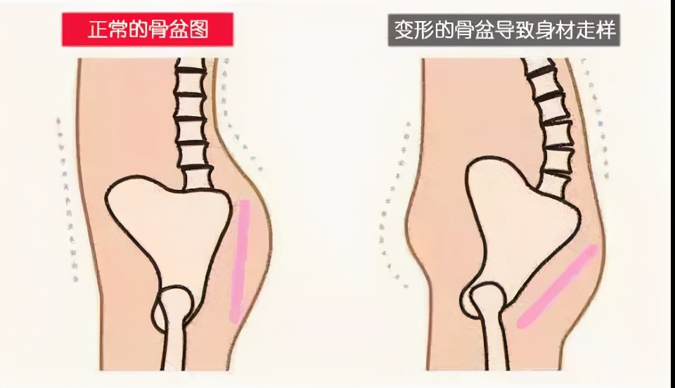 宝妈产后身体修复有哪些,宝妈的产后修复护理是什么