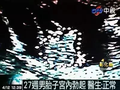 无知!坑娃!一个完全错误的“疾病”!居然还有专门的“诊室”!