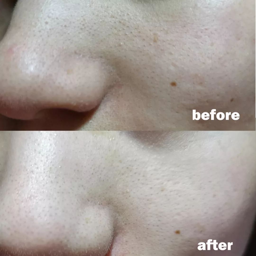 清洁面膜测评踩雷,清洁面膜测评排行榜前十位