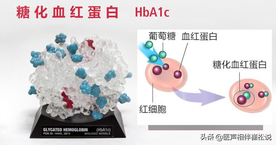 血糖怎么看正常范围是多少,血糖多少算正常如何诊断糖尿病