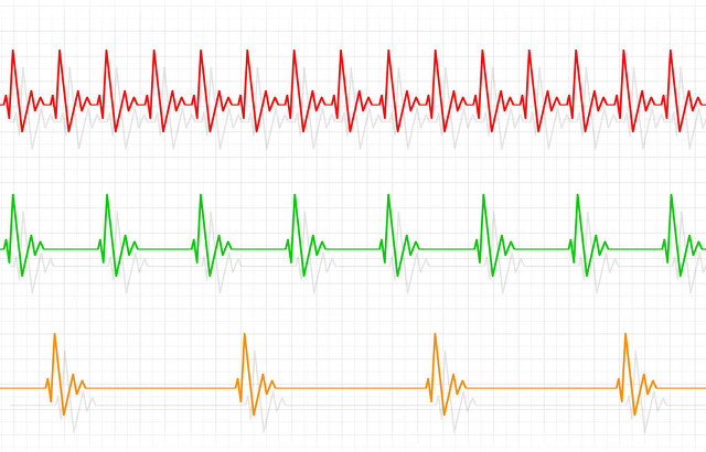心跳突然加快是什么原因,有时心跳突然加快心慌怎样调理
