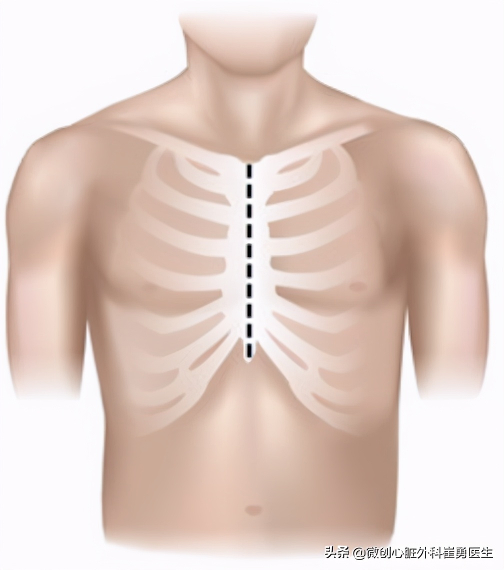 浙江省人民医院做心脏手术如何,浙江人民医院微创心脏手术