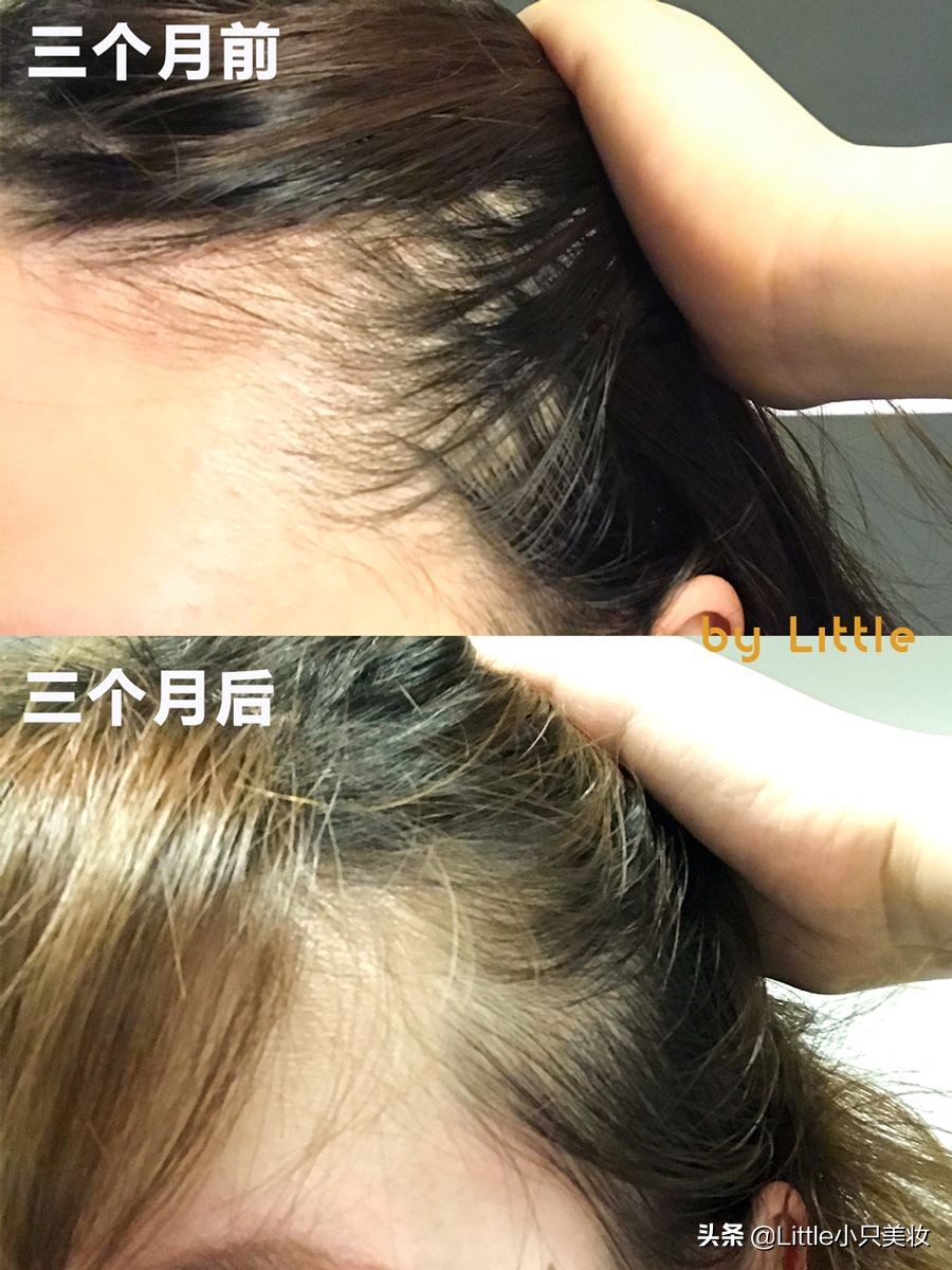 最好用的梳子不伤头发,最好用的梳头发梳子