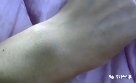 女子投诉快递员不送货上门遭暴打,女子投诉快递员遭登门暴打新闻