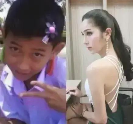 泰国整容的成功案例,全球整容技术最好的地方