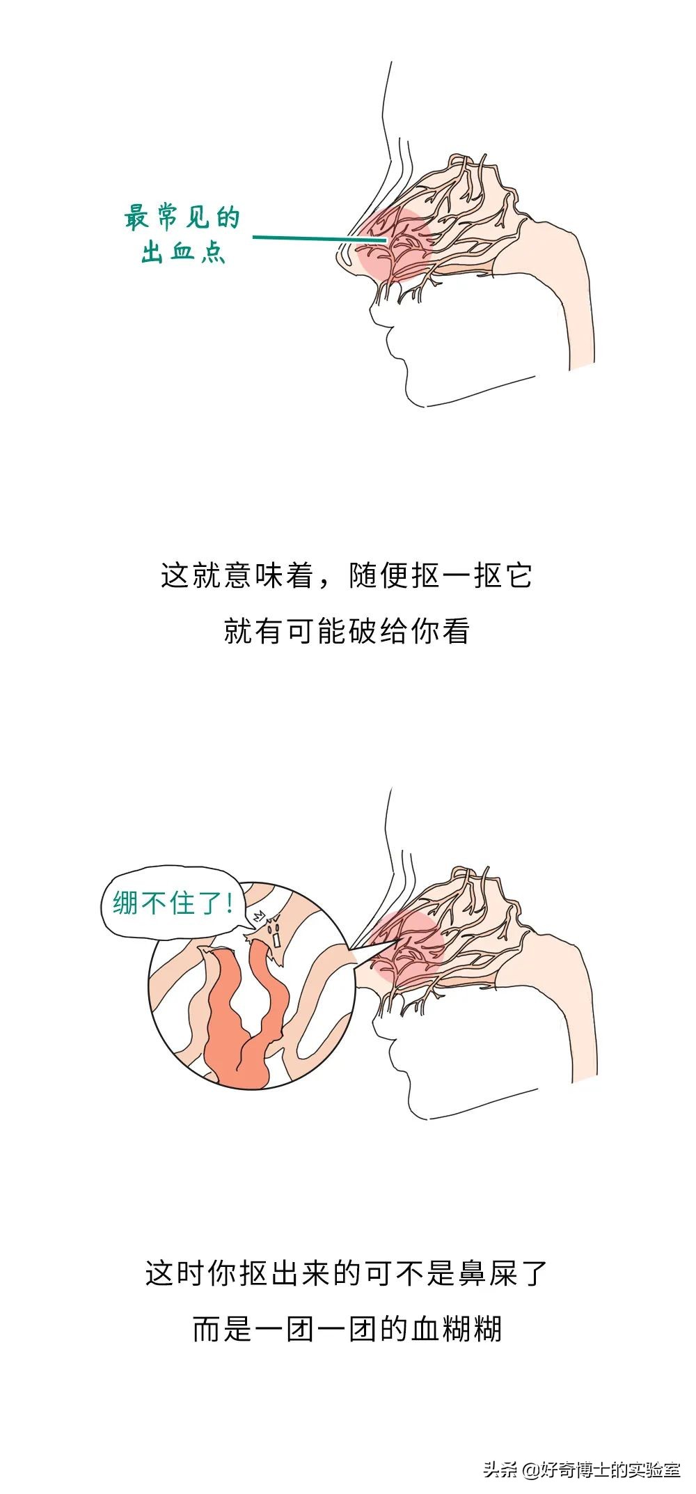 抠鼻屎把鼻子抠大的怎样解决,别再抠鼻屎了好吗