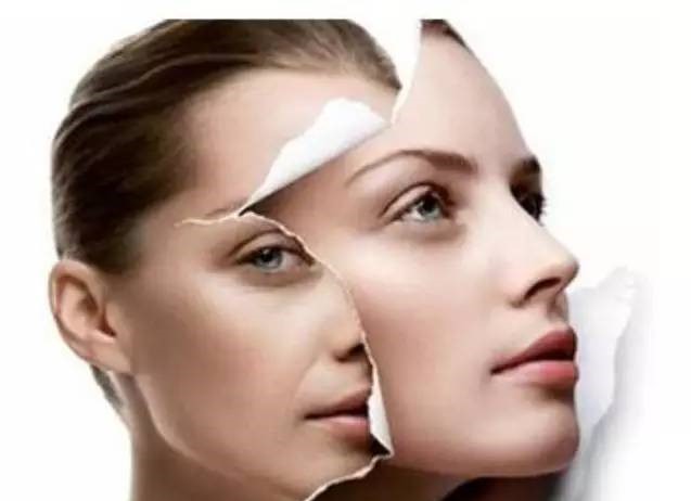 果酸换肤第一天晚上要敷面膜吗,果酸换肤跟光子嫩肤有什么区别