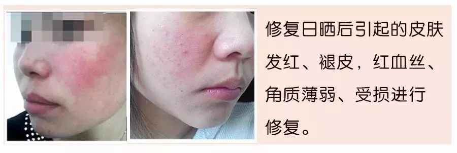 干粉冷冻,冷冻干粉的作用和功效