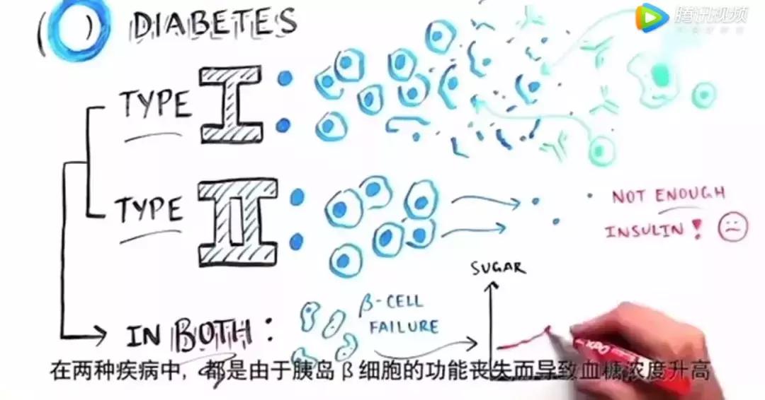 中国干细胞治疗糖尿病最新突破,中国医科大学干细胞治疗糖尿病