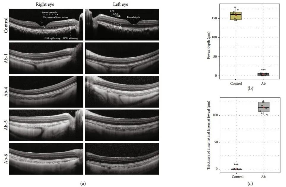 发现新型白化眼病猕猴模型,有望突破治疗人类眼皮肤白化病瓶颈|金子兵和占龙团队