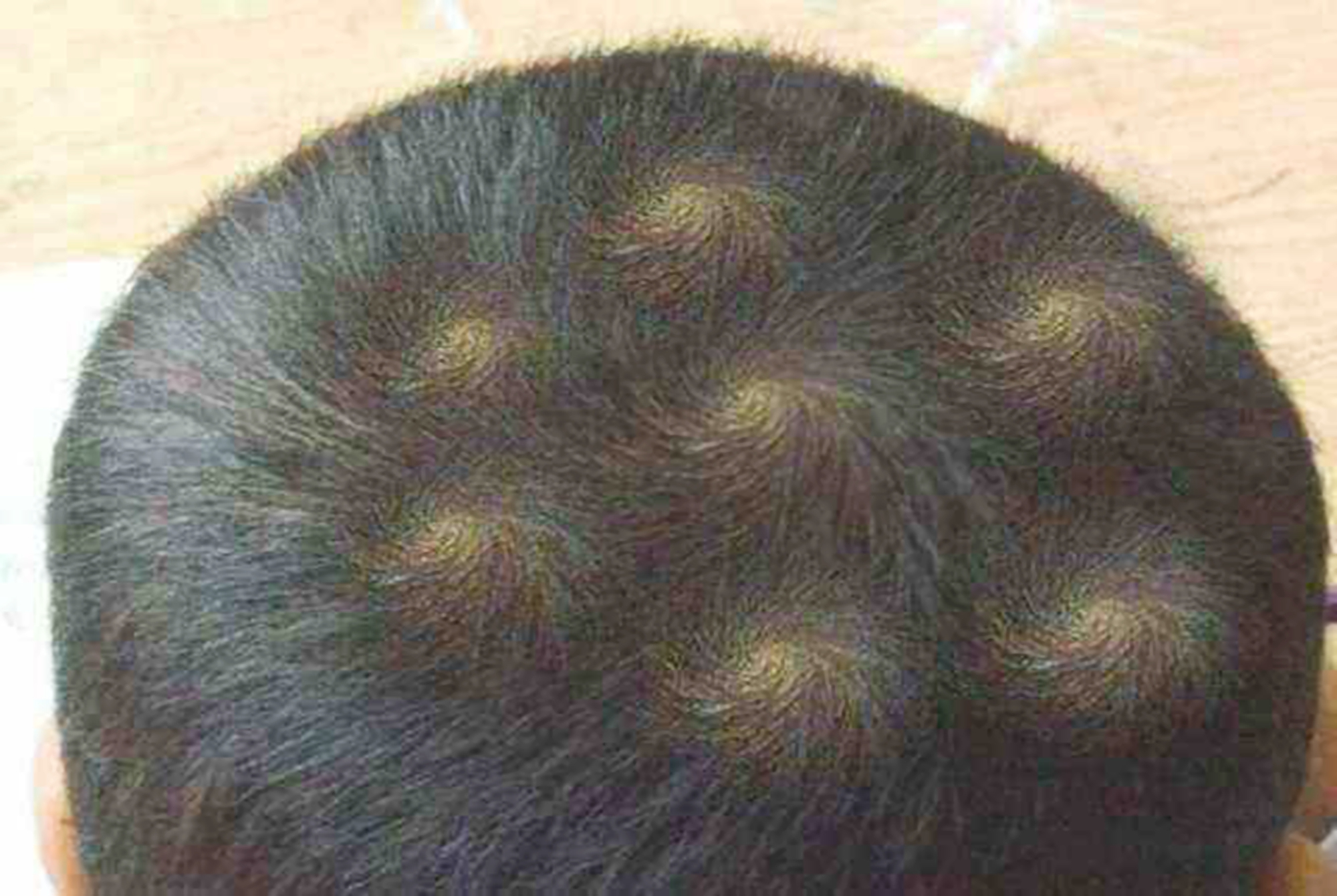 头旋决定性格和智商,头旋决定孩子的性格和智商