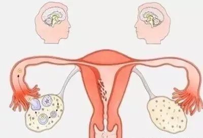 女生为什么会出现痛经现象呢,为什么女性会痛经需要注意什么