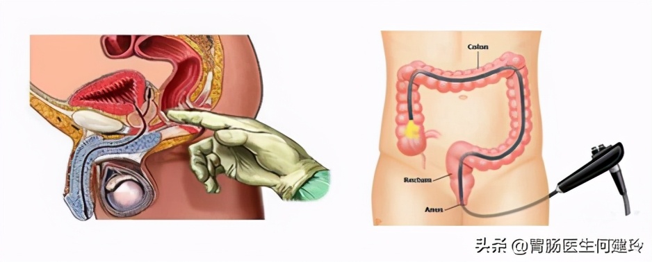 消化科医生有必要做肠镜吗,肠镜整个过程消化科医生能看到吗