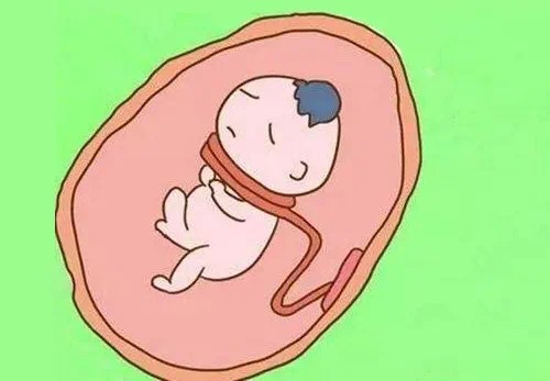 胎儿脐带绕颈有什么症状,胎儿脐带绕颈的症状有哪些