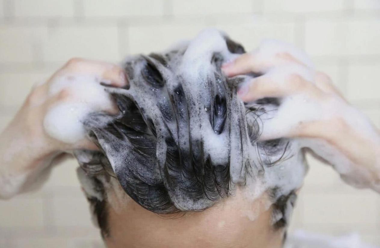 虱子童年回忆,20年前的虱子为什么消失了科普