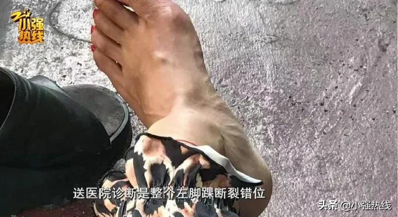 女子旅游崴脚骨折索赔18w,女子扭伤脚踝拆钢板赔偿