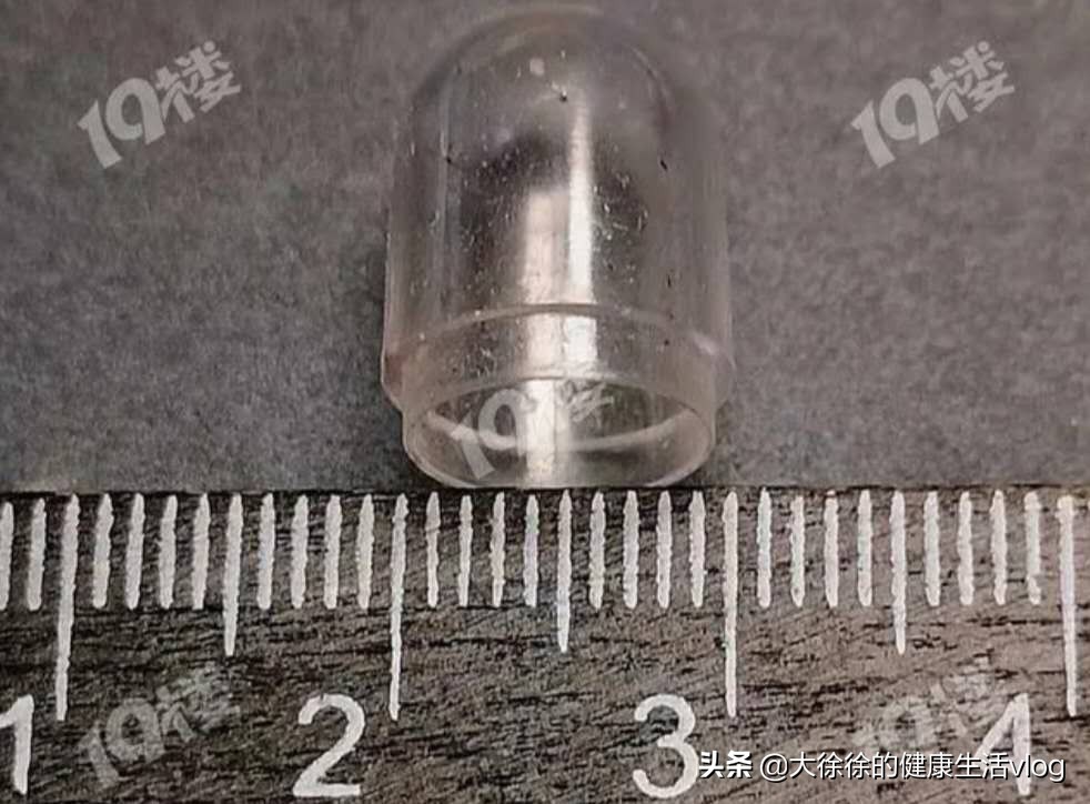 吞食异物怎么办,自己怀疑误吞异物怎么办