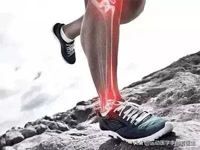 外踝关节扭伤怎么办,踝关节扭伤常用药