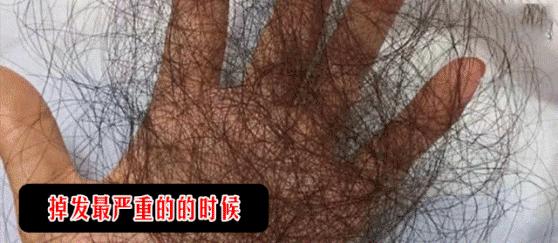 头发蓬松茶树油洗发水,油头救星澳洲茶树洗发水