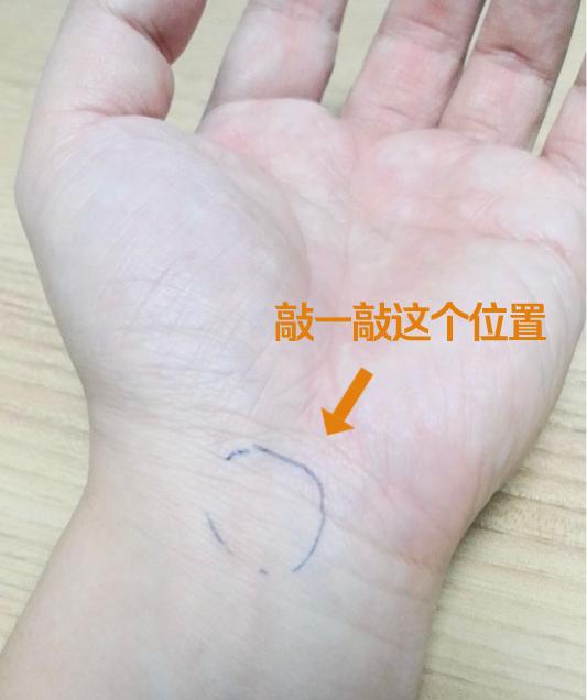 女子出现手麻，拖延1年后就医，手掌这地方已“瘪”掉！​年轻人易中招