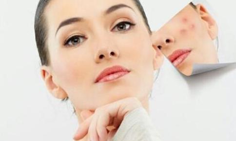 教你4个祛痘印最有效的方法,怎么去痘印最快最有效最简单