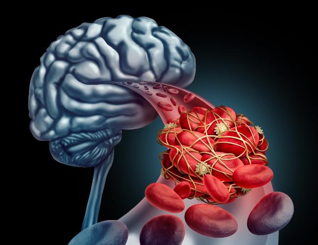 易疲劳总是犯困哈欠连天,哈欠连天但是没有困意