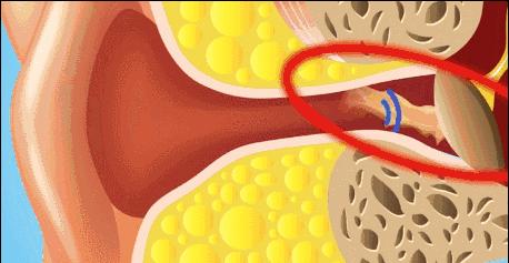 用棉签给宝宝掏耳朵,用棉签给宝宝清理外耳道