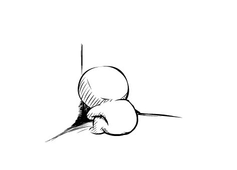 黑毛痣不治疗会怎么样,北京八大处整形医院治疗黑毛痣