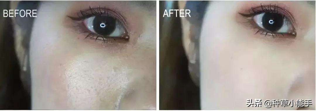 一抹磨皮棒,一抹磨皮