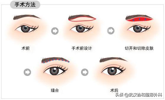 上海九院整形和协和整形,北京协和整形医院美容整形价格