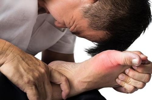 痛风是什么病西医叫什么,痛风是指哪