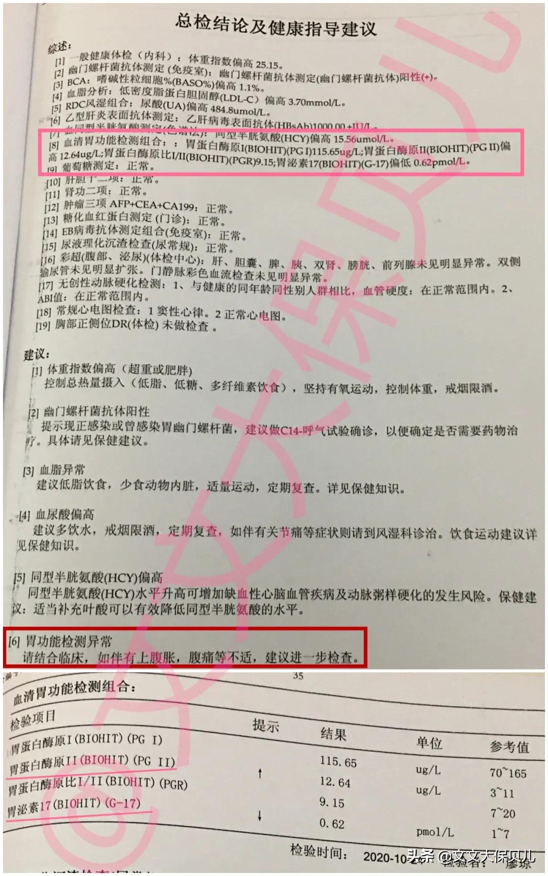 核保的短期重疾险,重疾核保