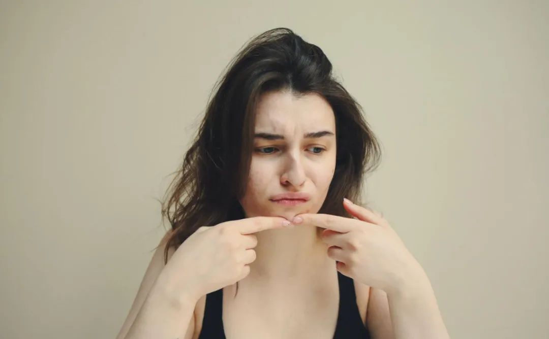 痘痘好了留下肉疙瘩怎么治疗,痘痘留下的瘢痕怎么去除