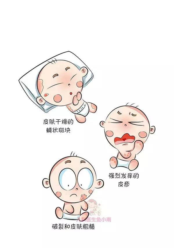 热疹皮疹湿疹有什么区别,湿疹和荨麻疹有什么区别怎样判断