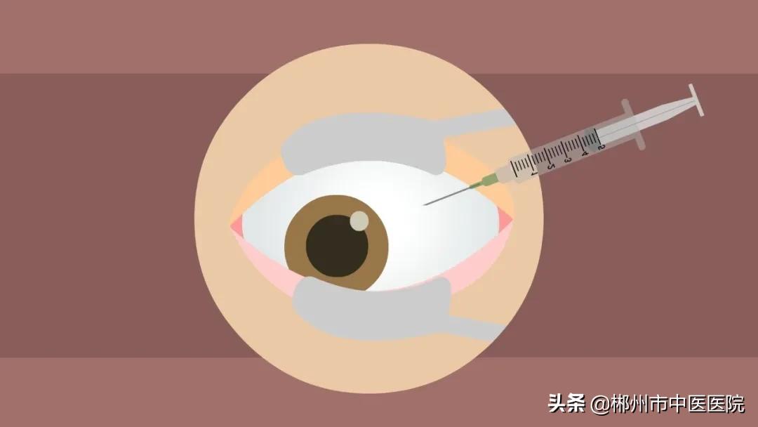 老年人视力障碍如何预防,老年人眼睛黄斑变性是什么意思