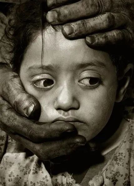 albertwatson鎽勫奖,albert鏃跺皻