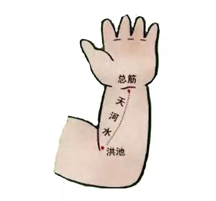 痱子反反复复偏方,中医痱子怎么消除