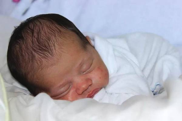 小宝宝湿疹严重怎么处理,湿疹半夜特别痒有什么小妙招