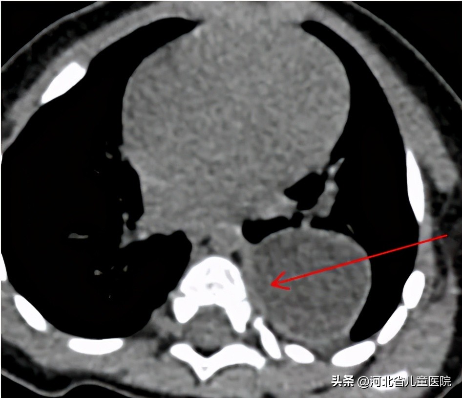 9个月大的孩子，总是咳咳咳咳咳咳咳咳咳咳，原因找到了
