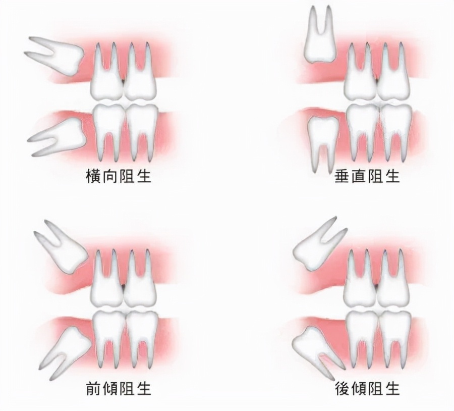 怎么样才能去香港看牙齿,香港哪个牙医最好