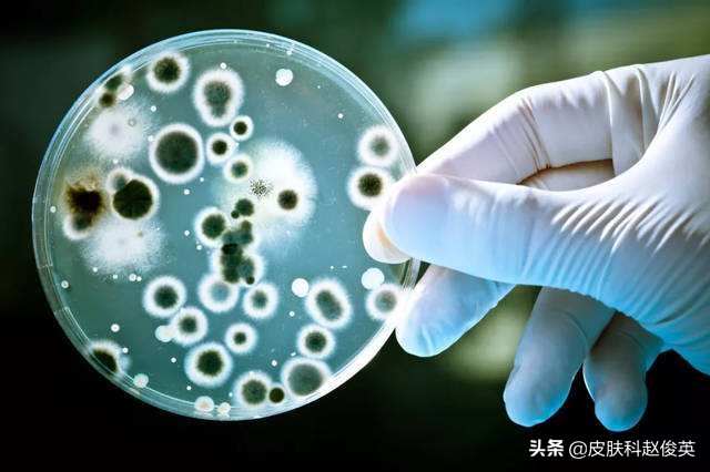 虫咬住了怎么办,被虫咬后出现什么症状要注意