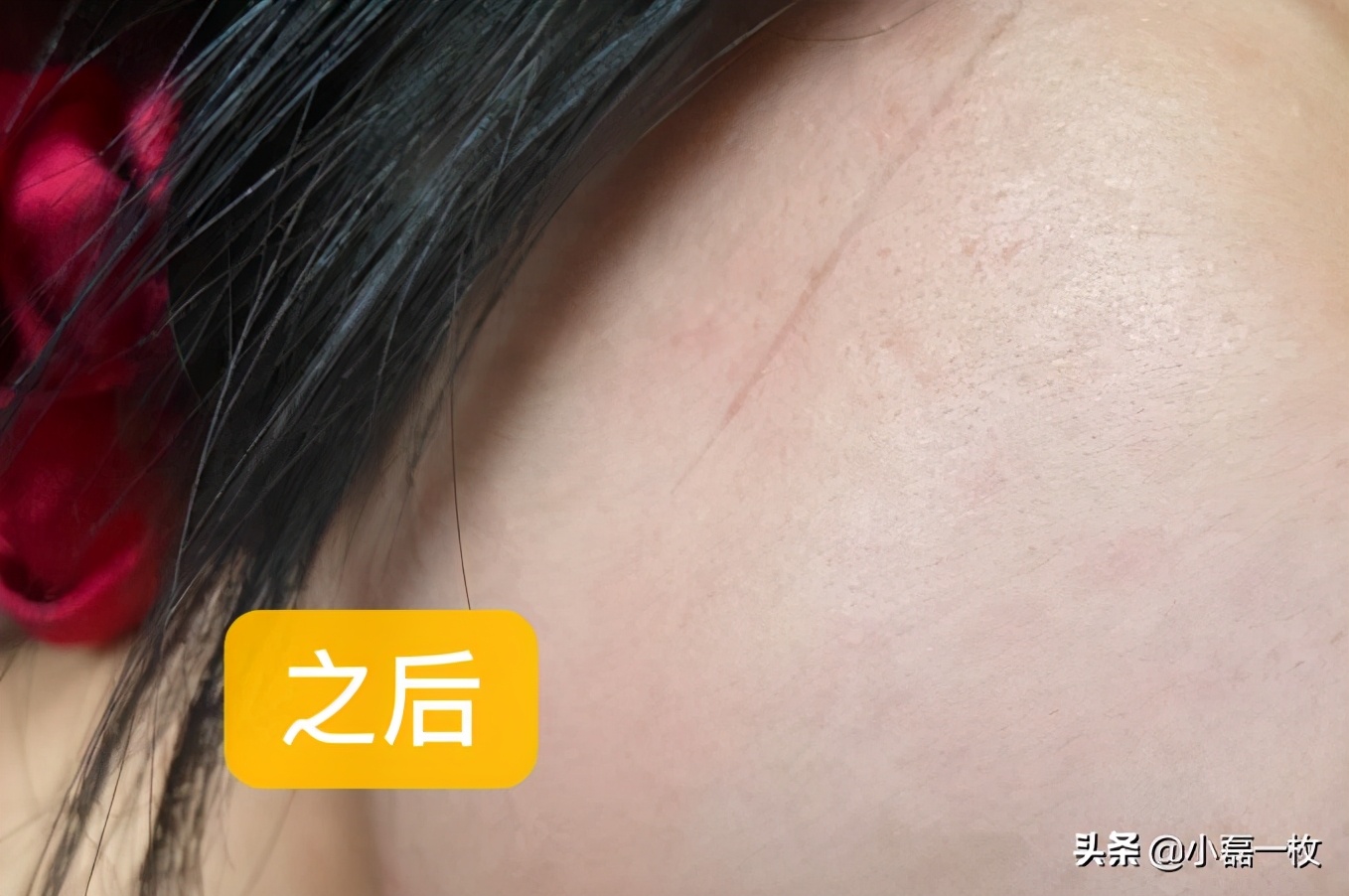 油性皮肤秋冬护肤步骤,油性皮肤护肤正确方法