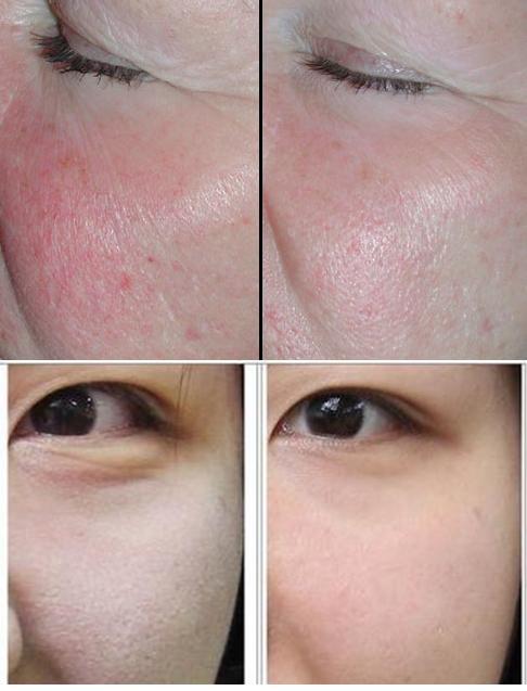 光子中微子区别,光子opt和mtt的区别