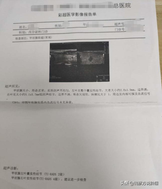 甲状腺结节3类有药吃能治好吗,甲状腺结节3类喝中药能治好么