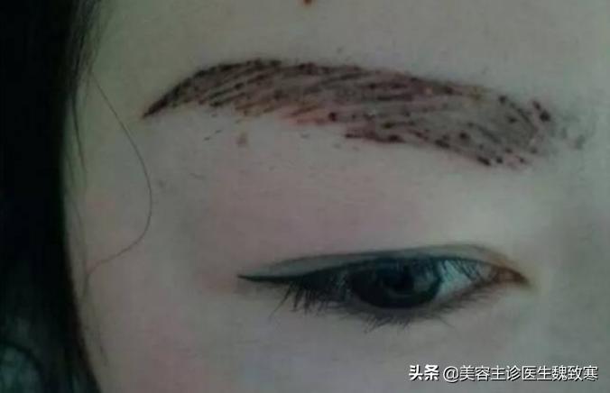 韩式纹眉有哪些种类,韩式纹眉痛吗