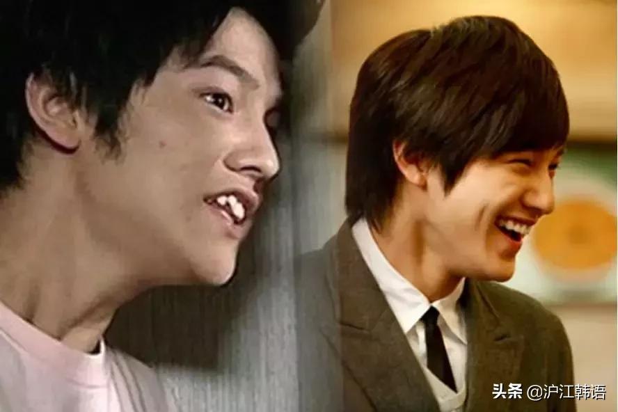 女明星矫正牙齿前后对比,明星牙齿矫正前后对比图