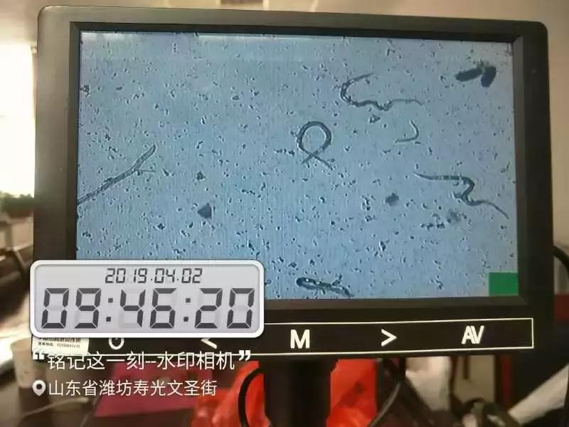 大姜种植过程容易产生的病害,大姜种植前如何预防病毒