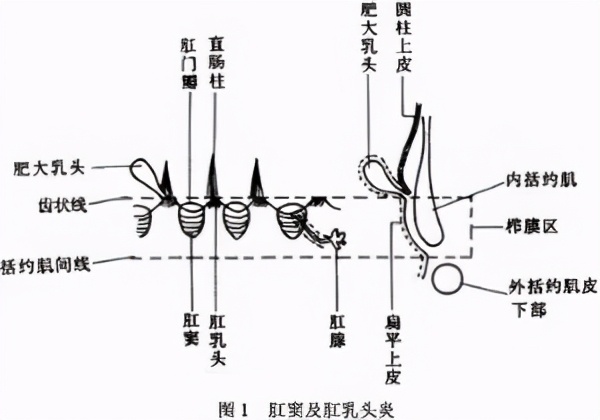 小孩肛窦炎怎么引起的,引发肛窦炎的因素有哪些