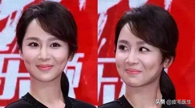 笑出法令纹！还能肆无忌惮地笑吗？正常笑！但改掉这5个习惯