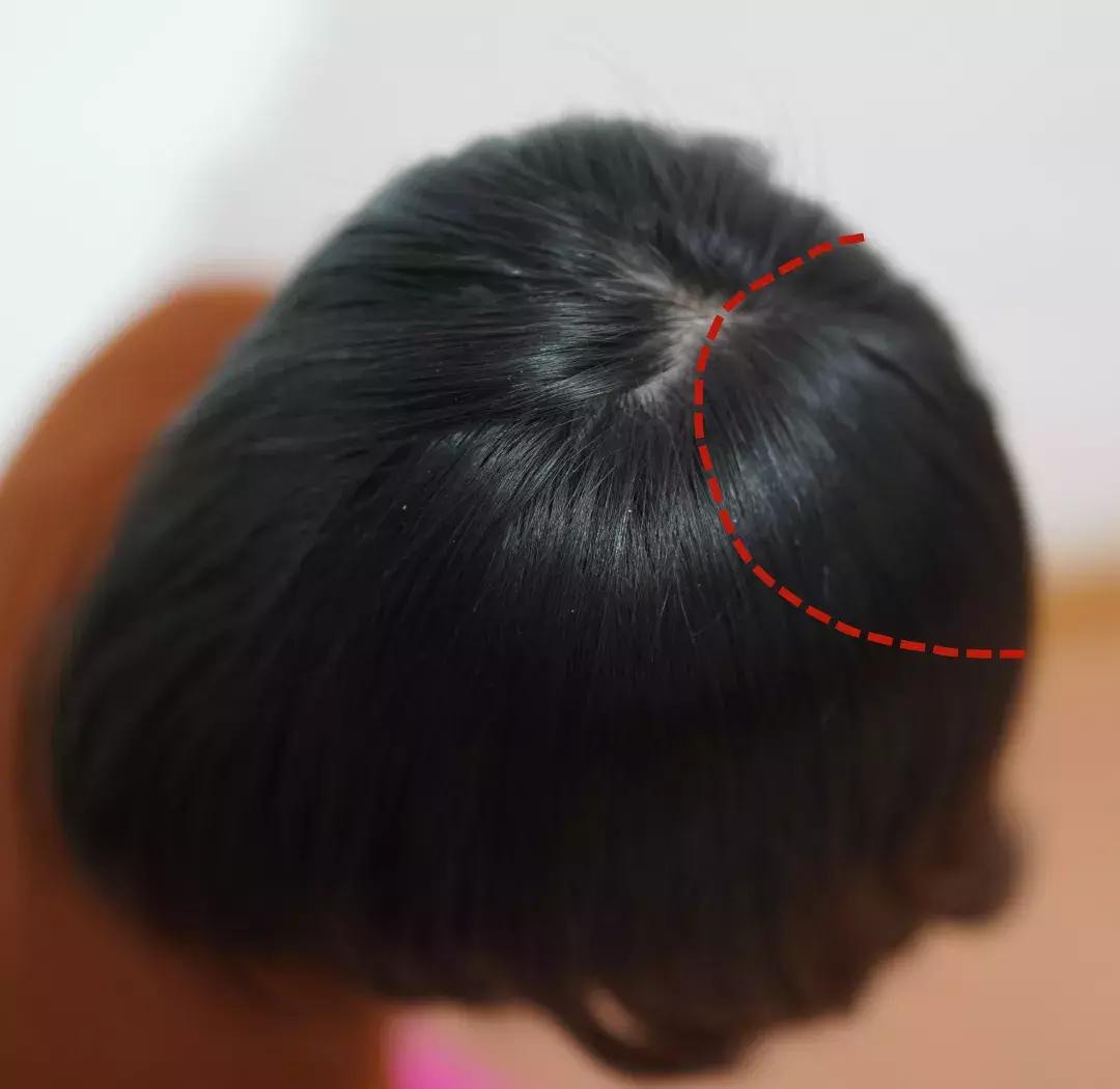 扁头怎么让头变得饱满些,扁头怎么办最快最有效